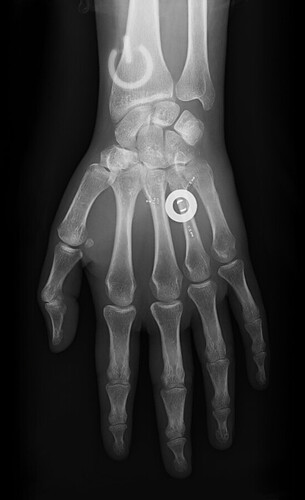 20201208-1