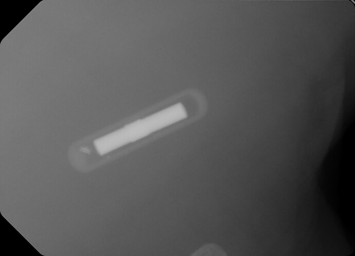 Implant