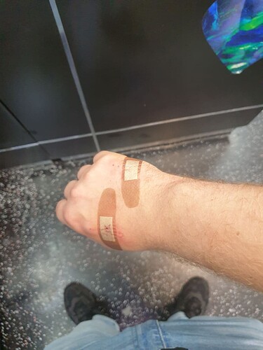 DT implant