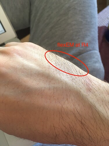 flexEM_R4