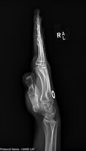 R_Hand_Knife