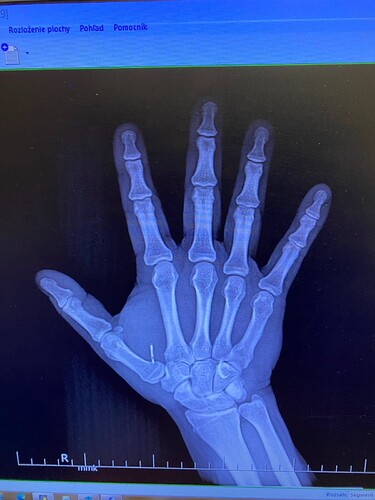 xrayFeb