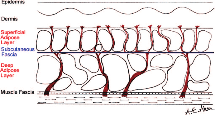 Superficial-and-deep-adipose-layers-separated-by-subcutaneous-fascia-in-abdominal