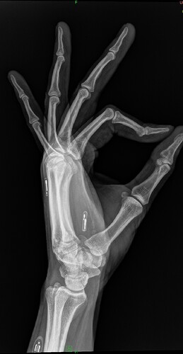 Lateral_left_hand