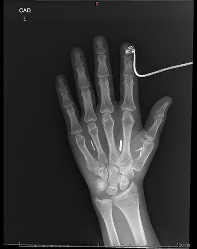 Left Hand