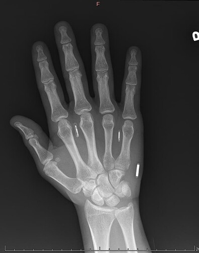 Right Hand