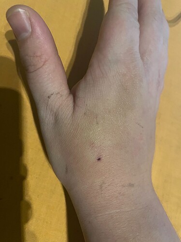 hand
