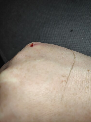 16491145512897181314096475102511