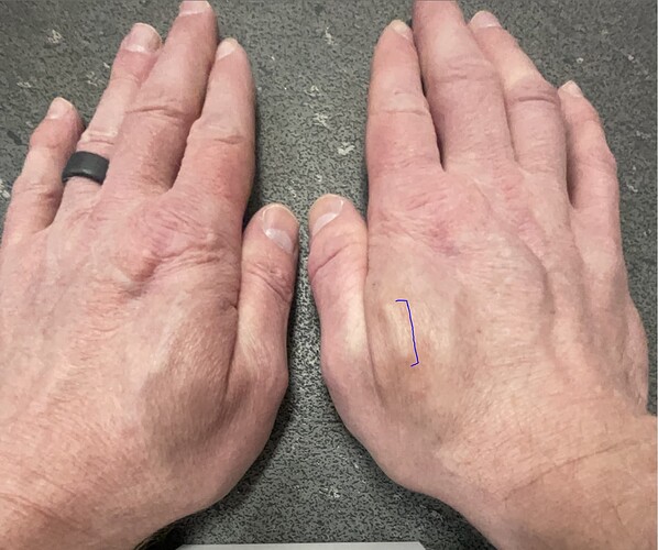 hand1.PNG