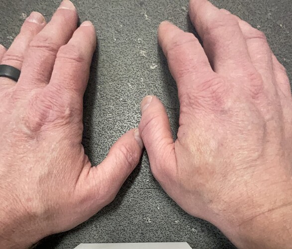 hand2.PNG