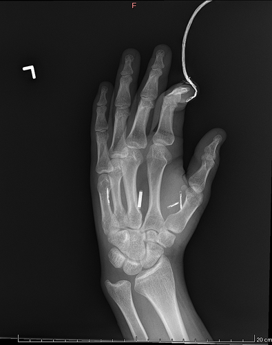 Left Hand 2