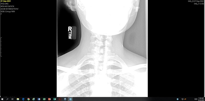 ZA Xray12