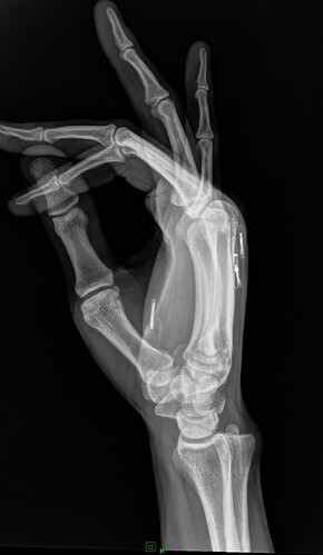 Lateral_right_hand