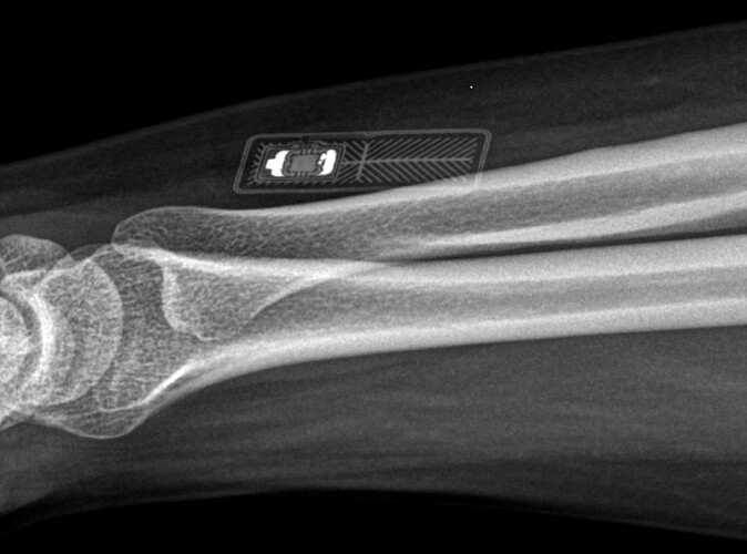 xray_3