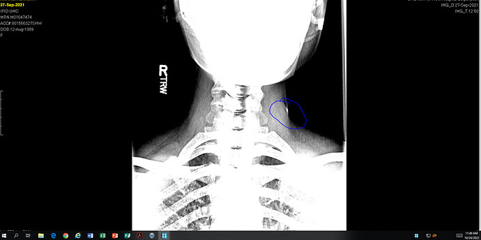 ZA Xray13-2.PNG