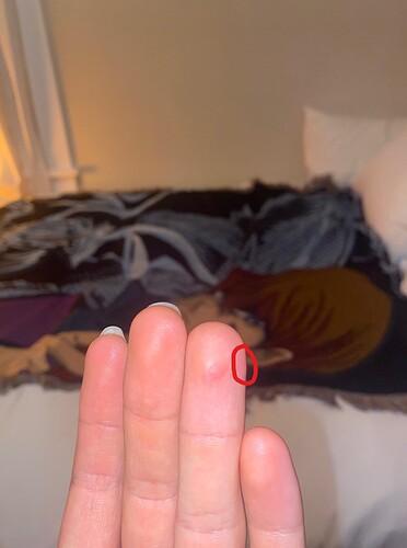 finger2