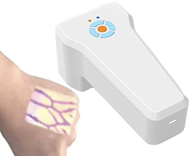 IR2