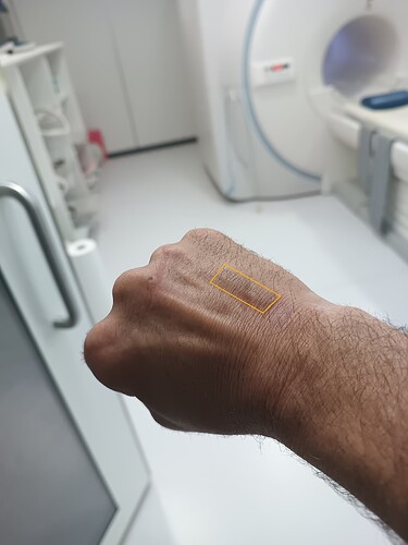Chip MRI