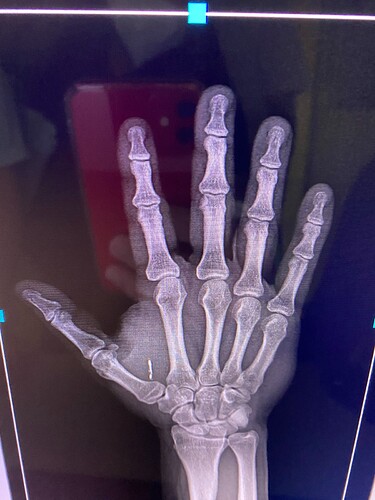 xray