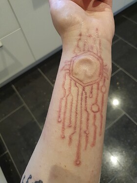 arm
