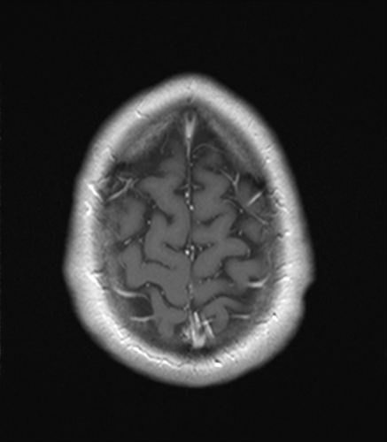 M_HEAD_NECK_MR_20220924_231041_25